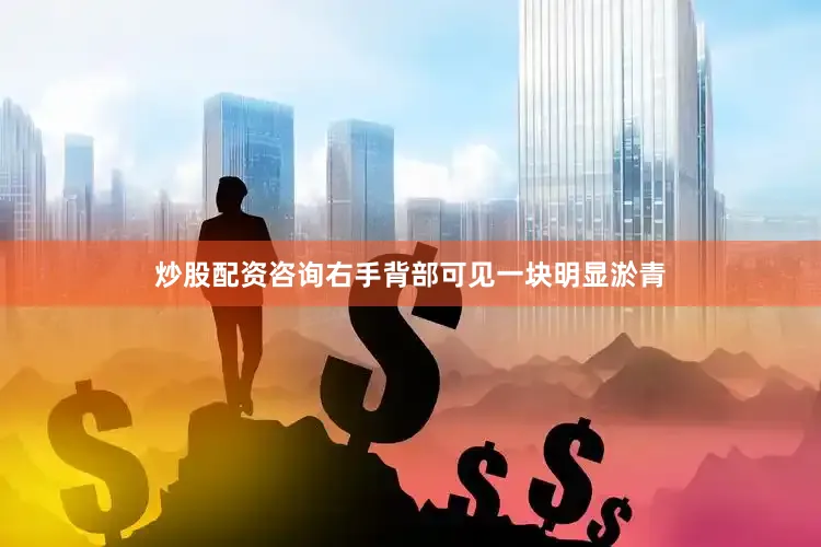 炒股配资咨询右手背部可见一块明显淤青