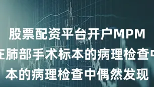 股票配资平台开户MPMN 通常是在肺部手术标本的病理检查中偶然发现